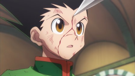 pic Bald Killua hunter x hunter netflix